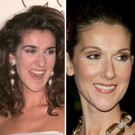 celine teeth|celebrities turning teeth.